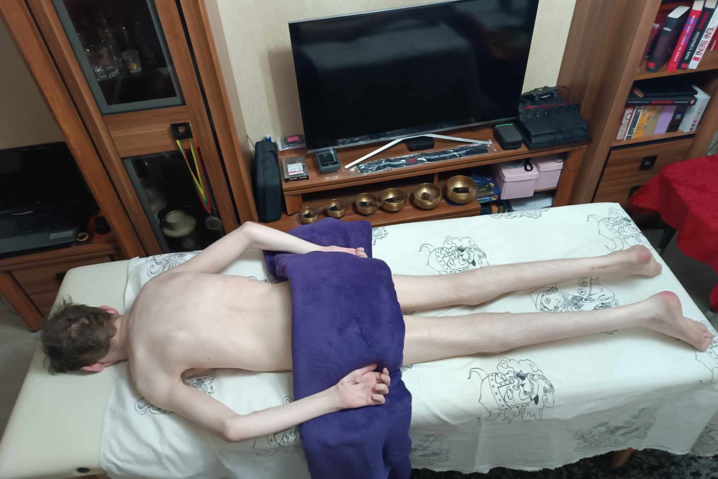  Mama išgyvena, kad Liutauras dabar labai sulysęs, nors apetitu nesiskundžia.<br /> Asmeninio archyvo nuotr.” class=”lazyload”></a></p>
<p>Retkarčiais ji randa ir kuo pasidžiaugti – kad ir tuomet, kai sodindama Liutaurą į vežimėlį paprašo jo ištiesti koją, ir jis tą padaro. Tai jam ne visuomet pavyksta, bet kai pavyksta, sukirba viltis – gal sūnui mankštos visgi padeda ir bent šiek tiek pagerės?</p>
<p>Vilties tėvams suteiktų ir žmonių pervestos lėšos – 1,2 proc. pajamų mokesčio – į Liutauro Sukausko labdaros ir paramos fondą. Šį fondą tėvai įkūrė prieš porą metų, supratę, kad sūnui reikia kuo daugiau įvairių procedūrų, kad jis pasijustų bent kiek geriau.</p>
<p>„Būna dienų, kai turiu vilties, kad viskas dar susitvarkys, bent truputį pagerės, gal jis bent kažkiek galės pastovėti ant kojų, kaip praėjusį rudenį. O kartais atrodo, kad jau viskas, pabaiga. Atrodo, net kai žmogus suserga vėžiu, yra gydymas, vaistai, o mūsų atveju nieko nėra“, – guodėsi mama.</p>
<p>Liutauro labdaros ir paramos fondo rekvizitus<a href=