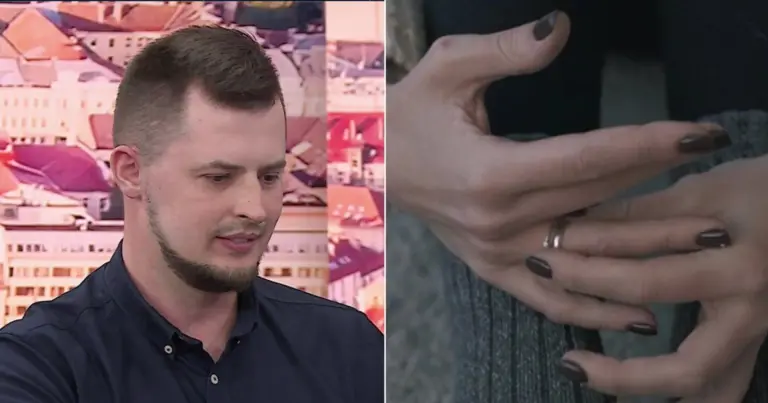 Matui netekus rankų jį paliko sužadėtinė: „Jam tai buvo smūgis žemiau juostos“