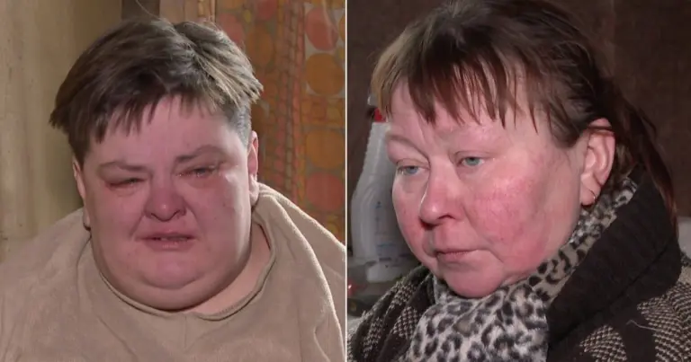 Moteris gelbėtojus iškvietė ne tik sau, bet ir draugei: „Regina, tau irgi reikia“