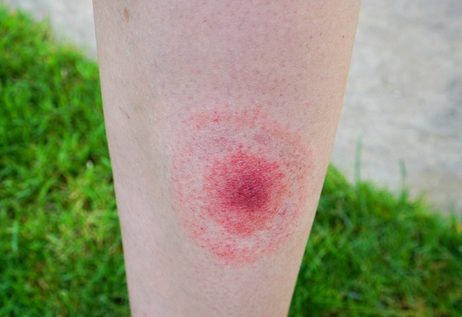 Laimo liga (nuotr. Shutterstock.com)