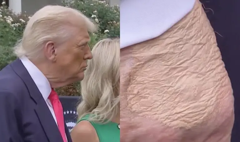 Išplitusi nuotrauka sukėlė susirūpinimą dėl Trumpo sveikatos
