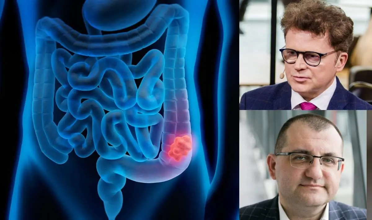 Profesoriai sukritikavo lietuvių ypač pamėgtą produktą: kelia storosios žarnos vėžio riziką