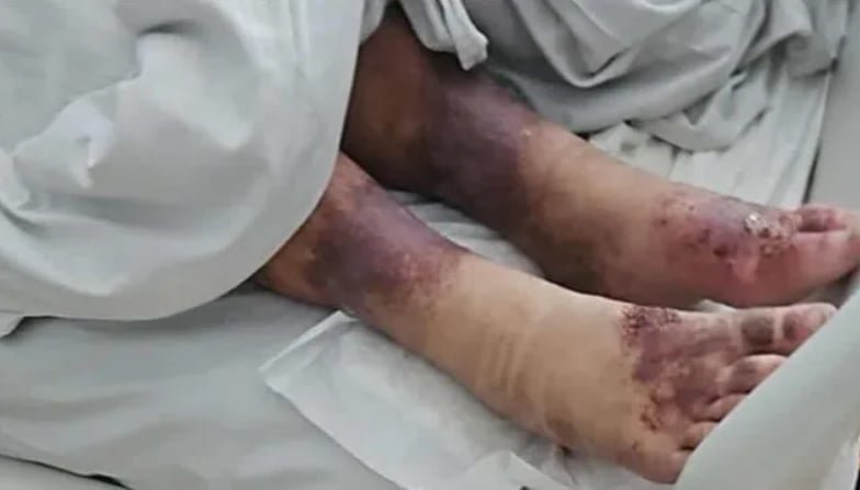 Lenkijoje surasta 27 metus dingusi moteris (nuotr. socialinių tinklų) Lenkijoje surasta 27 metus dingusi moteris (nuotr. socialinių tinklų)