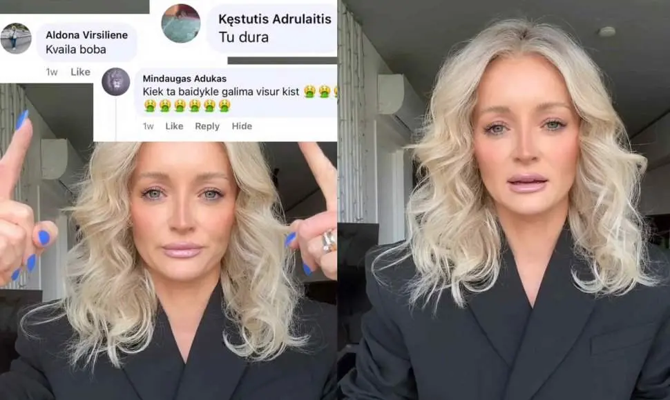 Ugnė Siparė rėžė purvą ant jos pilantiems žmonėms – pareiškimas nustebino ne vieną