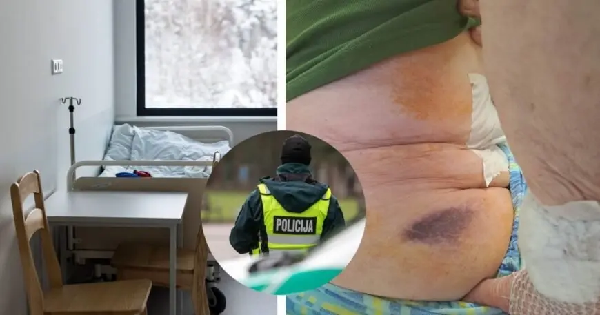 Košmaras: Dukra pašiurpo išvydusi mamą ligoninėje: ant kūno – kraujosruvos, o garso įraše išgirdo grasinimus
