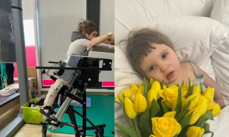Po bronchitu slėpėsi klastingas herpesas: visiškai sveika pusantrų mergytė liko prikaustyta prie lovos