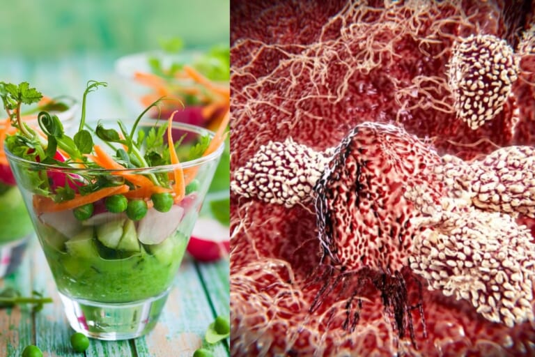 Mokslininkai: veganiška mityba ir metionino ribojimas – ar tai gali padėti gydyti vėžį?