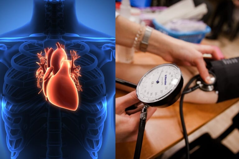 Kauno tyrimas atskleidžia: daugiabučio gyvenimas siejamas su aukštesne hipertenzijos ir cholesterolio rizika