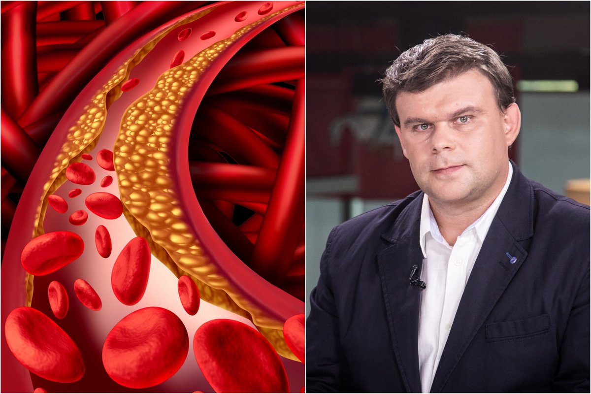 Gydytojas Morozovas atskleidžia: 4 plačiai paplitę mitai apie cholesterolį ir ką svarbu žinoti