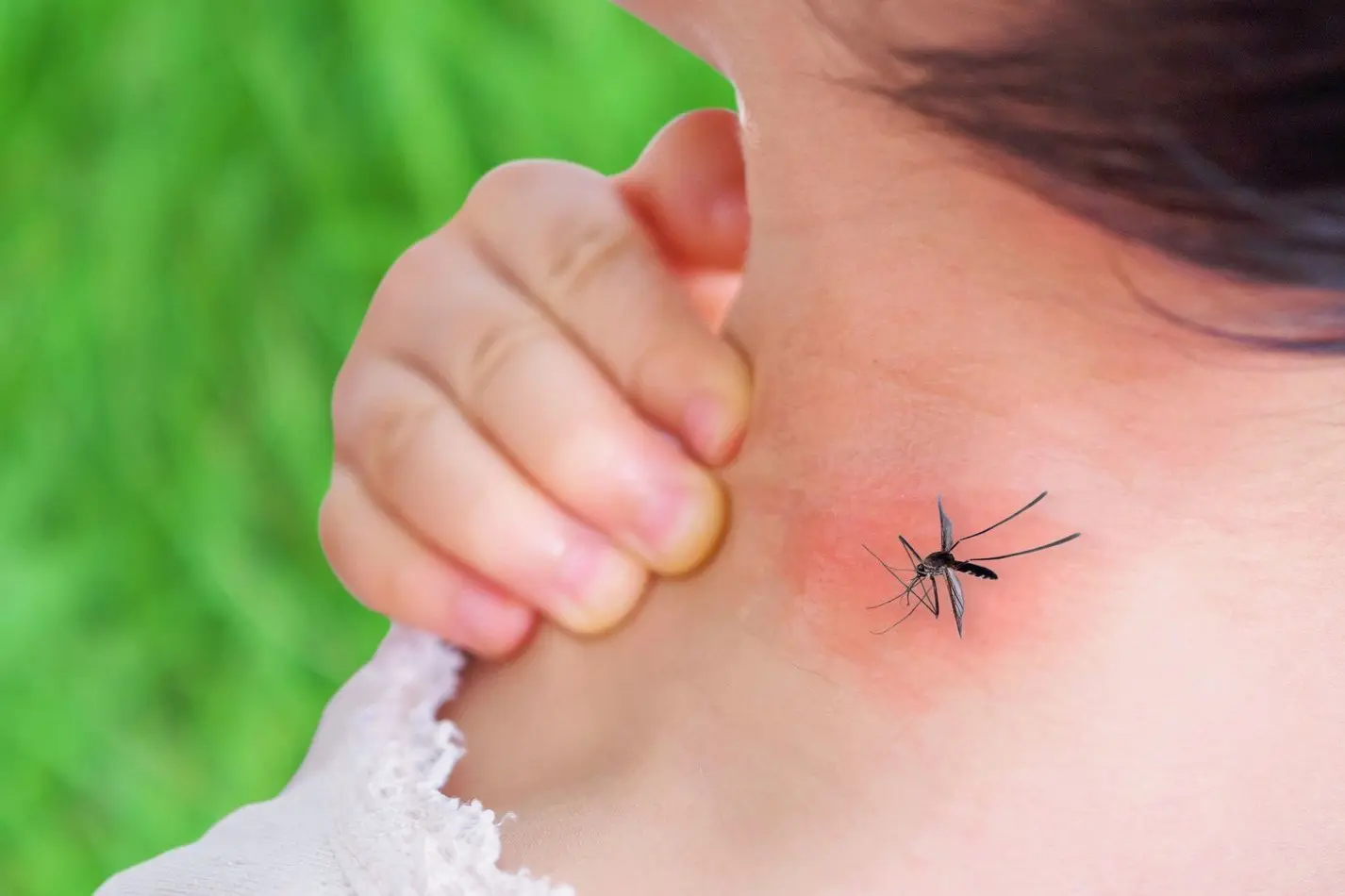 Kaip apsisaugoti nuo vabzdžių įkandimų: vaistininkės patarimai saugiai vasarai