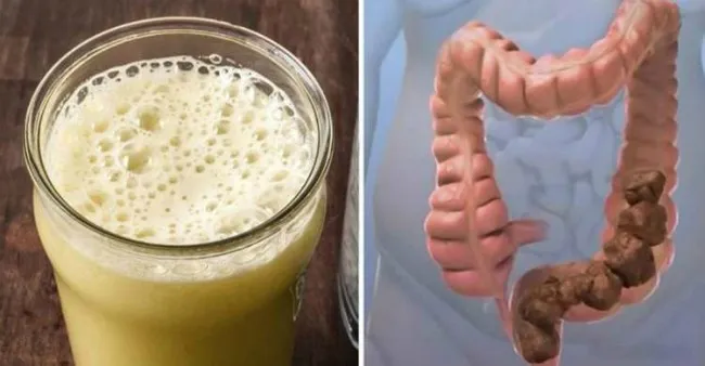 Štai 3 geriausi būdai, kaip pašalinti iki 5 kg toksinų iš žarnyno