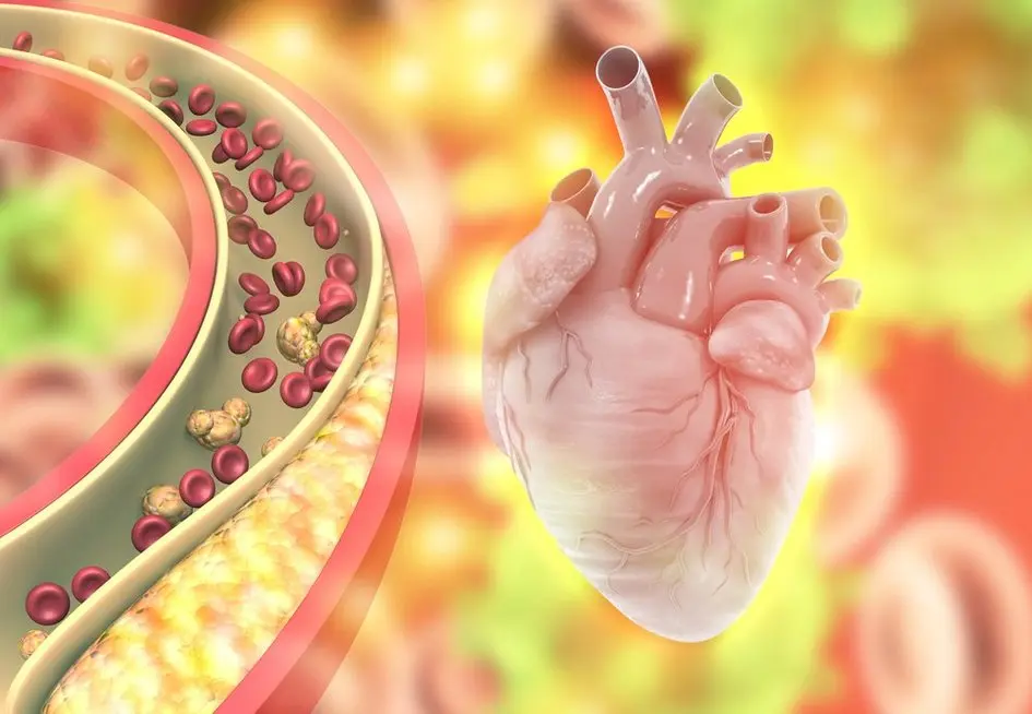 Padidėjęs cholesterolis (nuotr. Shutterstock.com) Padidėjęs cholesterolis (nuotr. Shutterstock.com)
