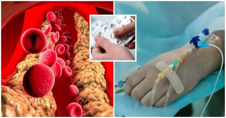Apie statinus sklando daugybė mitų – specialistė atskleidė, kas nutinka cholesteroliui ir infarkto rizikai