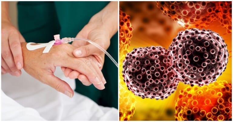 Žinomų žmonių vėžio diagnozės atvėrė skaudžią tiesą: kodėl ligos atvejų daugėja ir Lietuva išlieka tarp „lyderių