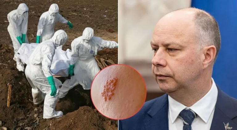 „Bus ne viena mirtis“: Veryga įspėja dėl galimo maro protrūkio Rusijoje – ligoninėse jau karantinas
